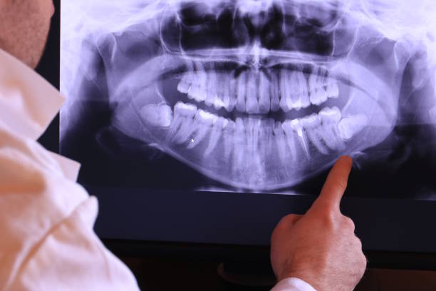 Best Emergency Dental Services for Seniors in Lake Norman Of Catawba, NC